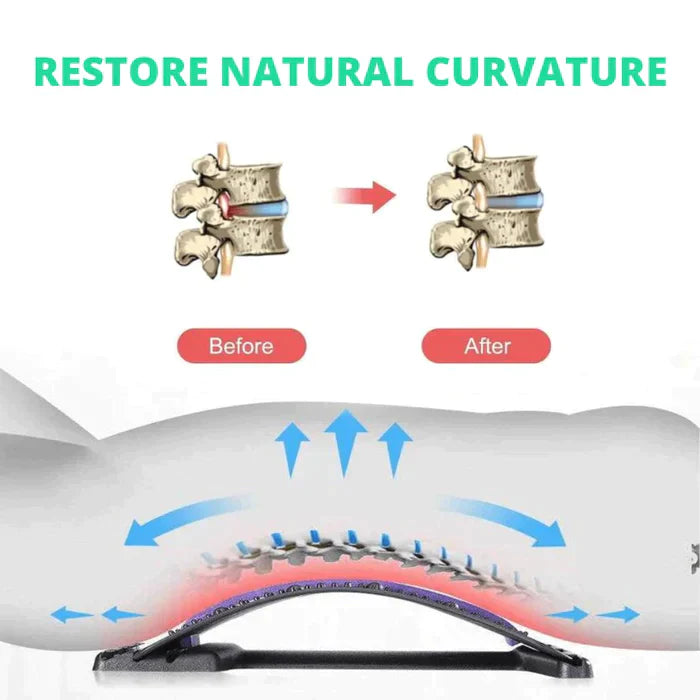 Adjustable Back Stretcher